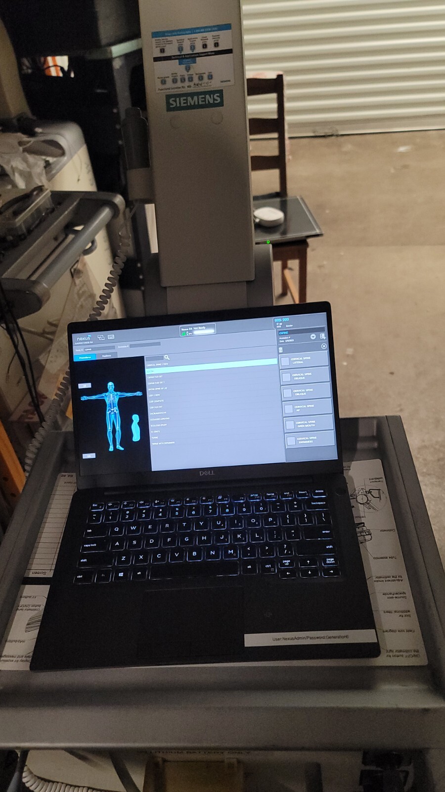 mobile digital ray machine siemens canon