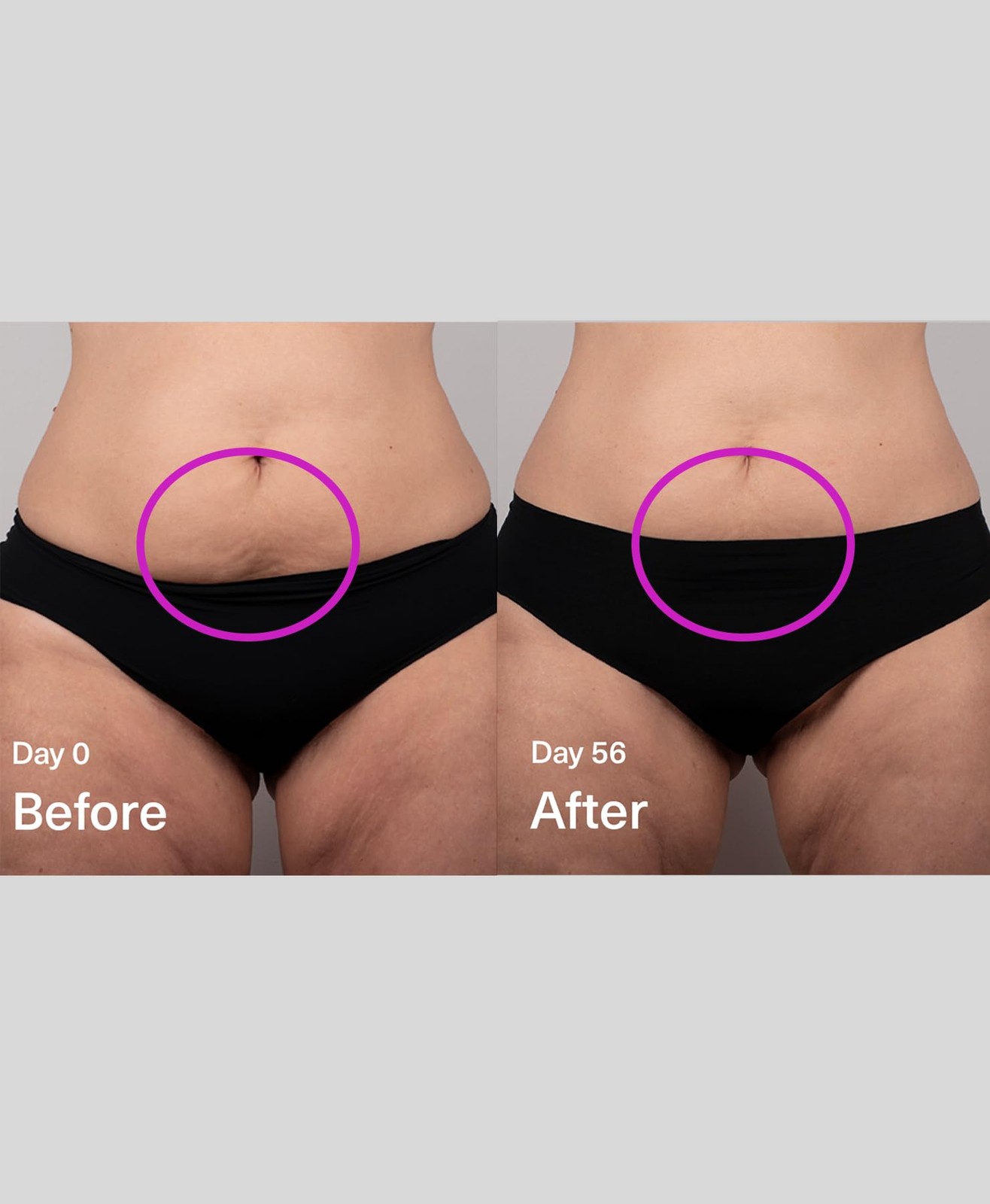 SickScience DropOff Advanced Exosome Body Firming & Sculpting Cream | Targets St
