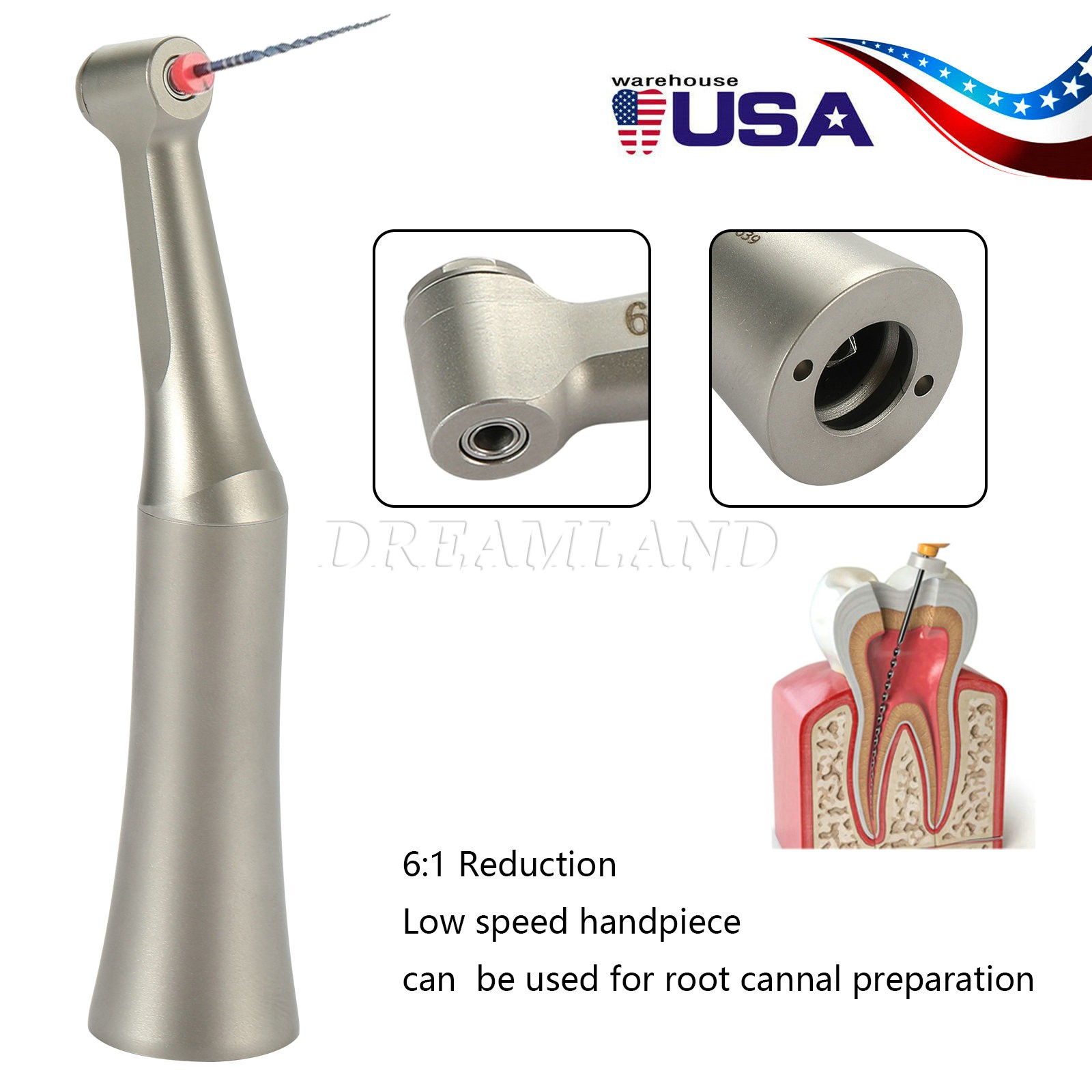 Dental 6:1 Reduction Endo Contra Angle Handpiece/ Engine Niti Files 25mm E2
