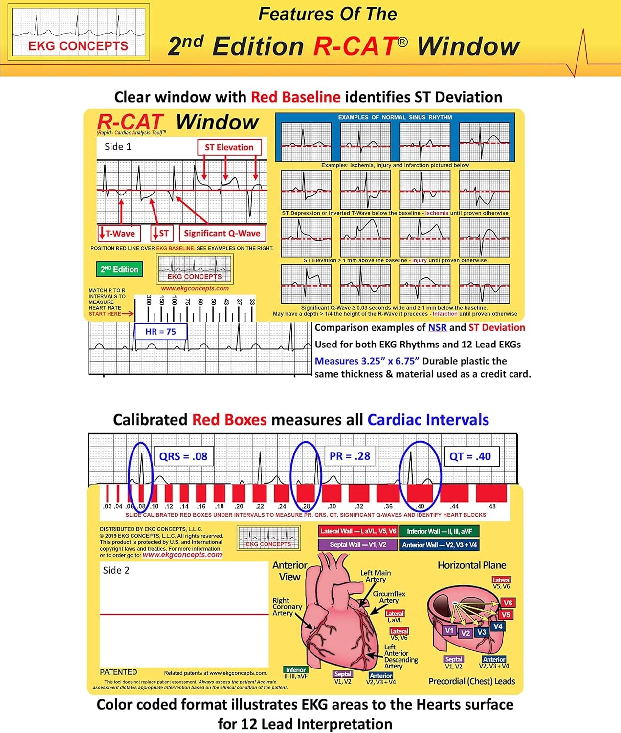 R-CAT EKG Window 2nd Edition Yellow