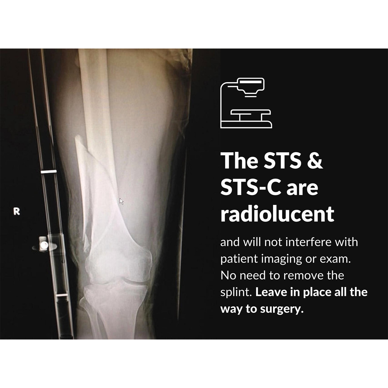Slishman Traction Splint Compact (STS-C)