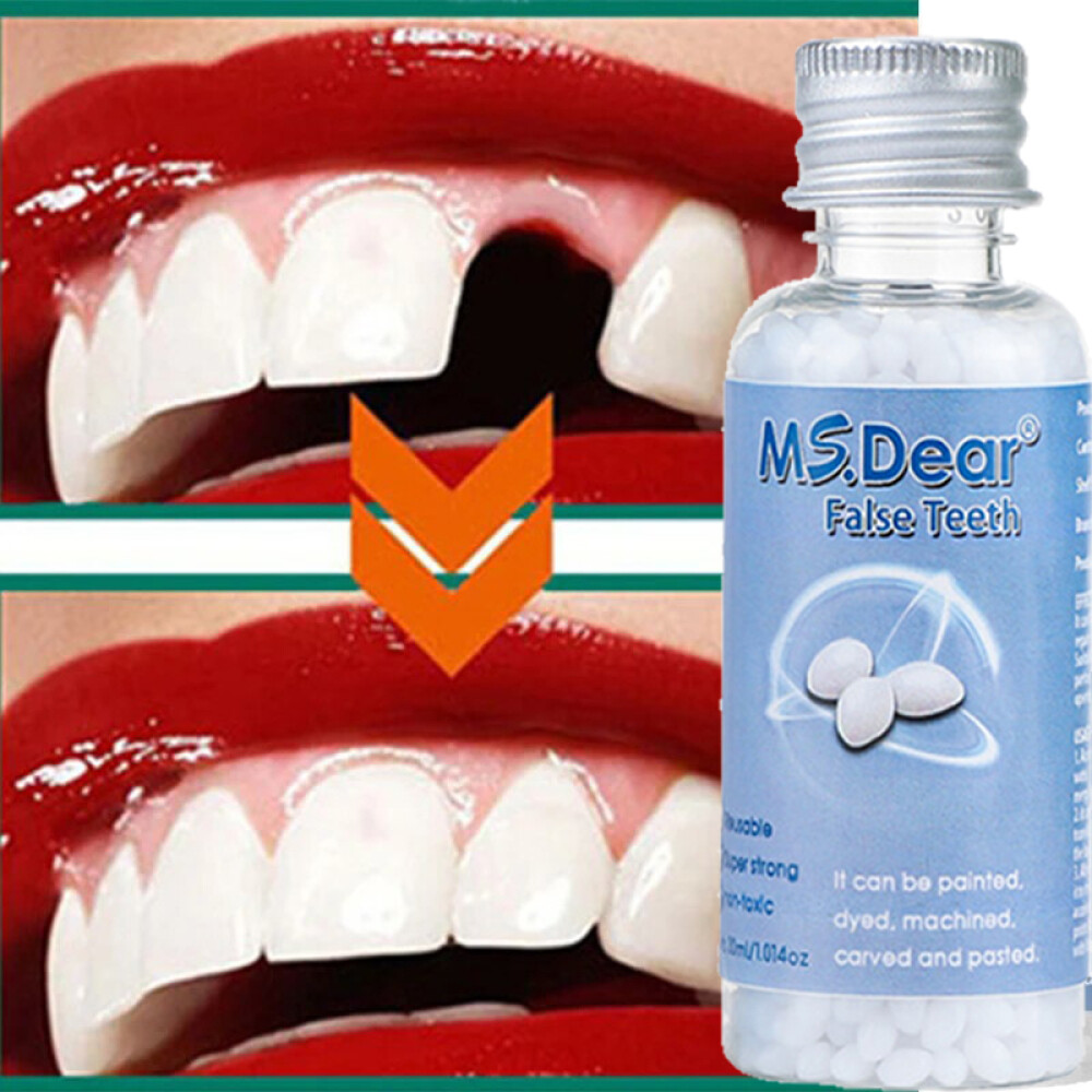 Tooth Repair Granules Temporary Kit Fitting Bead Reusable Moldable False Teeth
