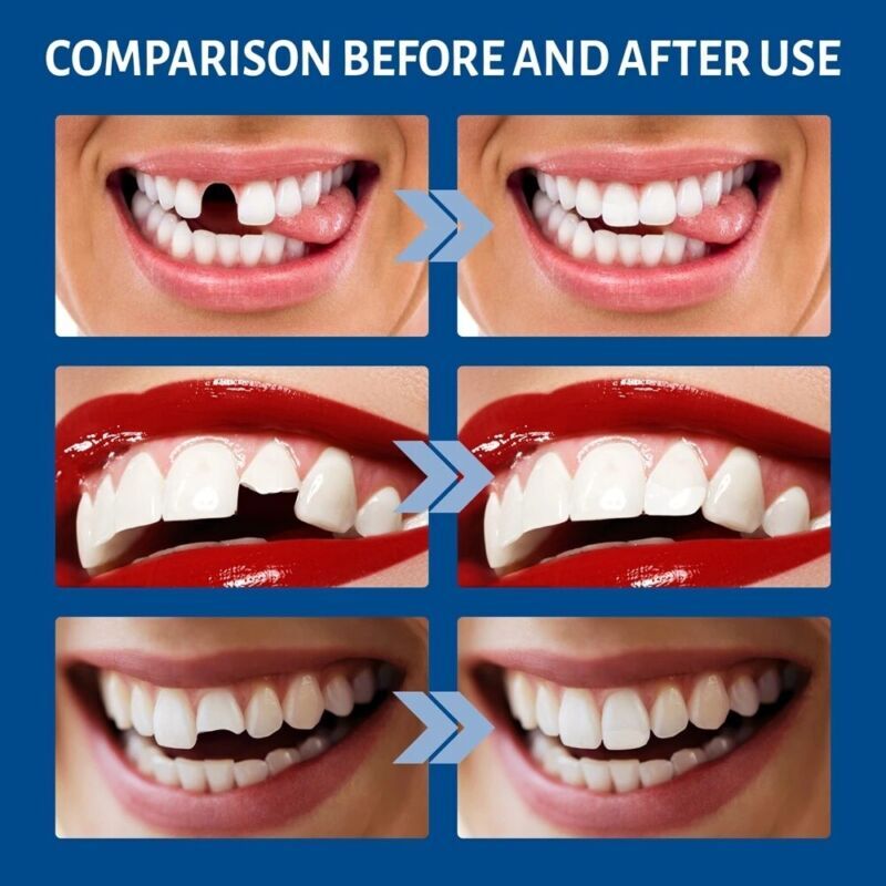 False Teeth Solid Glue Temporary Tooth Repair Moldable Fix Broke Gap Teeth 30ml