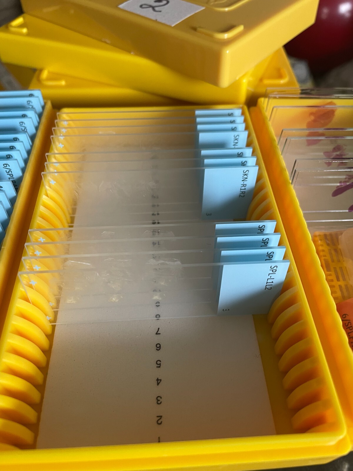 Microscope storage boxes with mouse tissues slides