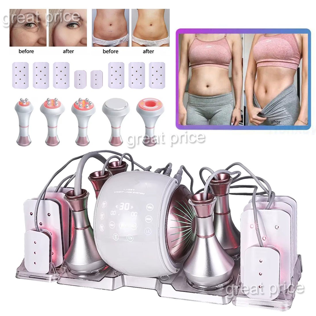 80K 6 In 1 Body Slimming Machine RF Anti-Wrinkle Rejuvenation Skin Lift Tighten