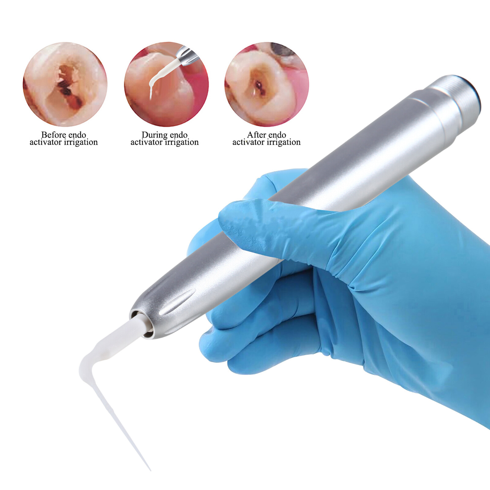 Dental Air Scaler Handpiece 5 Endo Irrigation Tips Compatible with KAV 2Hole DL