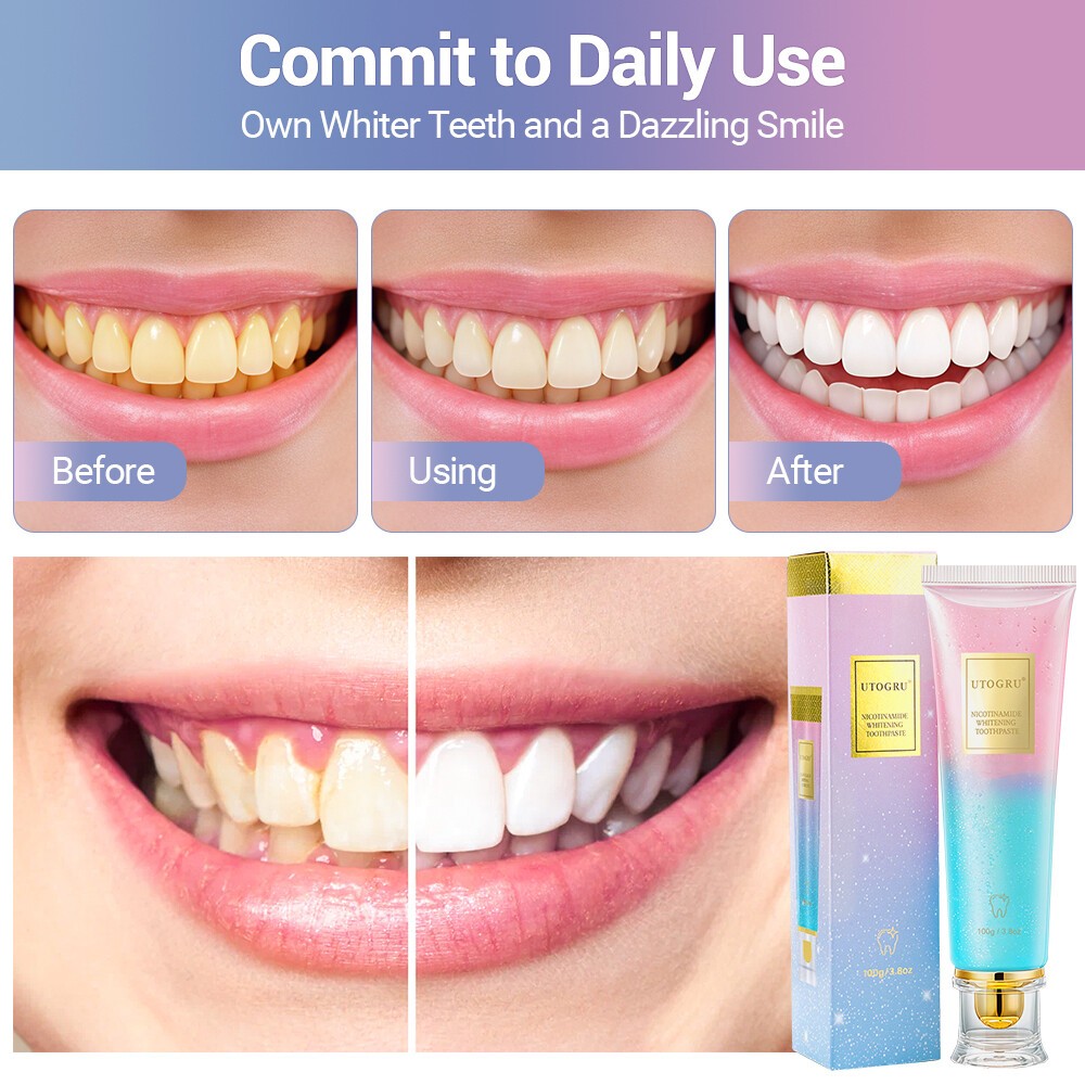 Nicotinamide Whitening Toothpaste Fresh Toothpaste Breath Remove Surface Stains
