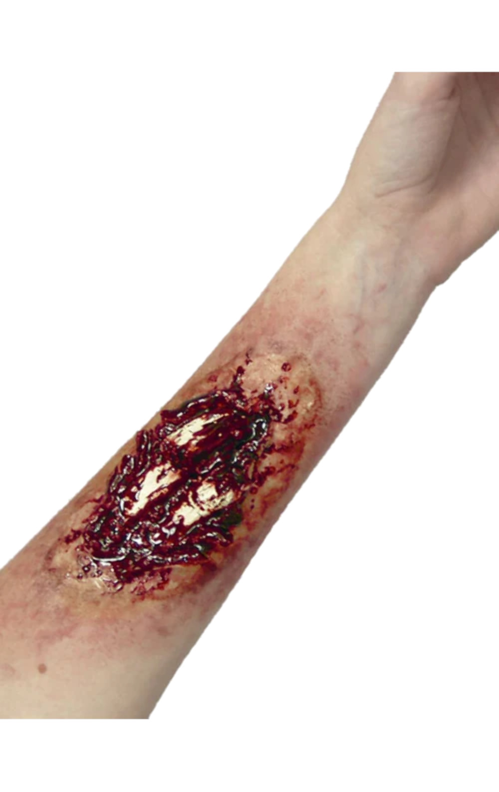 Woochie Broken Bone