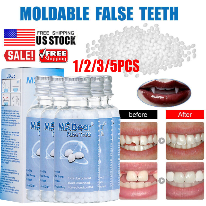 Temporary Tooth Repair Kit Fix Broken Teeth Fill Gaps Denture Damage Glue Filler
