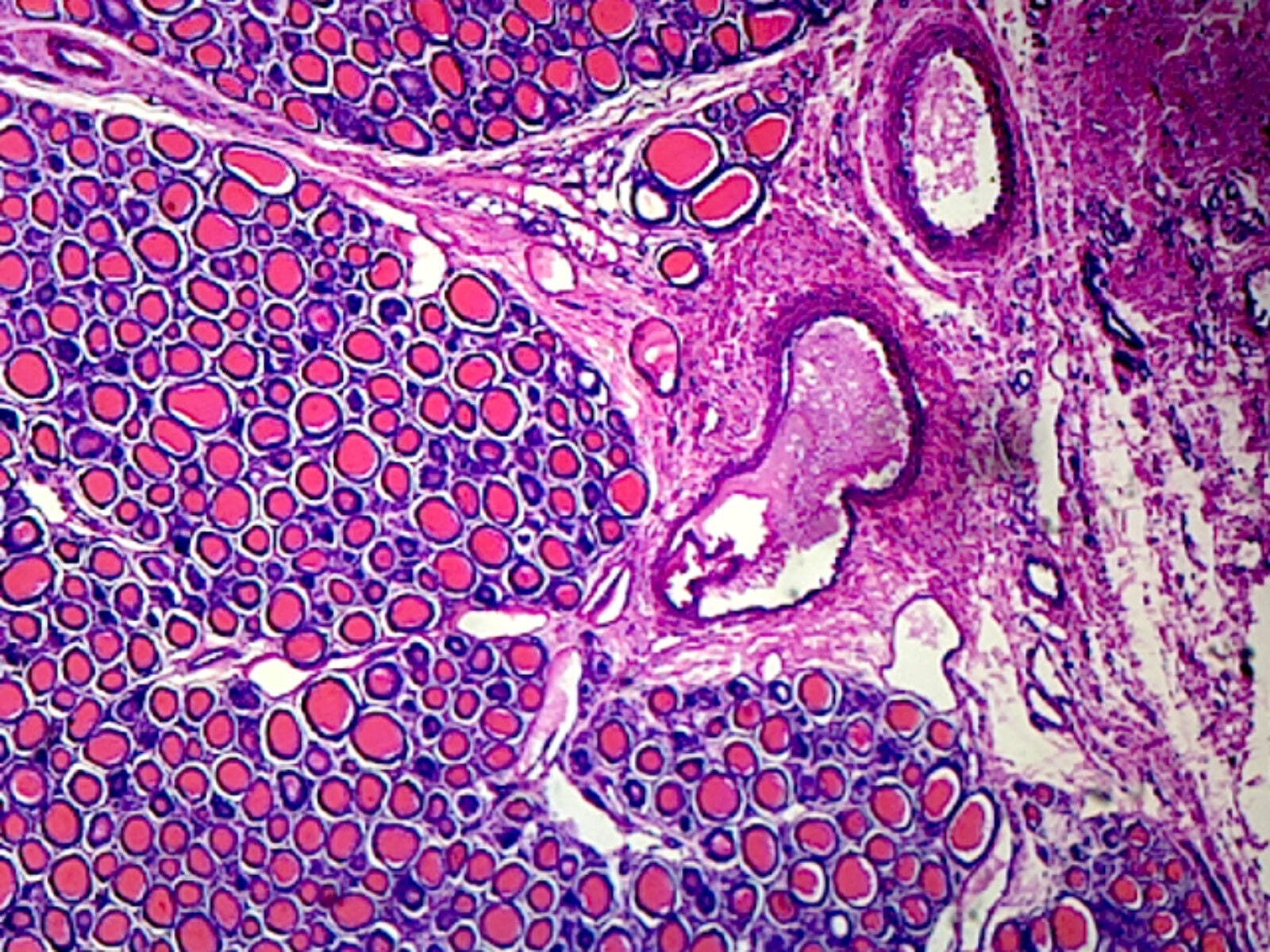 Thyroid Gland, Mammalian; Section