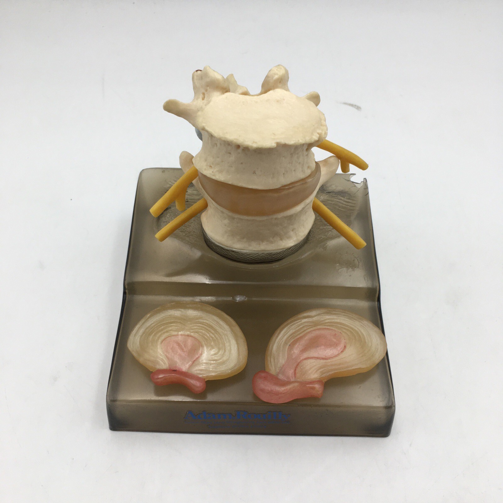 SOMSO QS68/3 Central and Dorsolateral Hernia Model of Intervertebral Disc