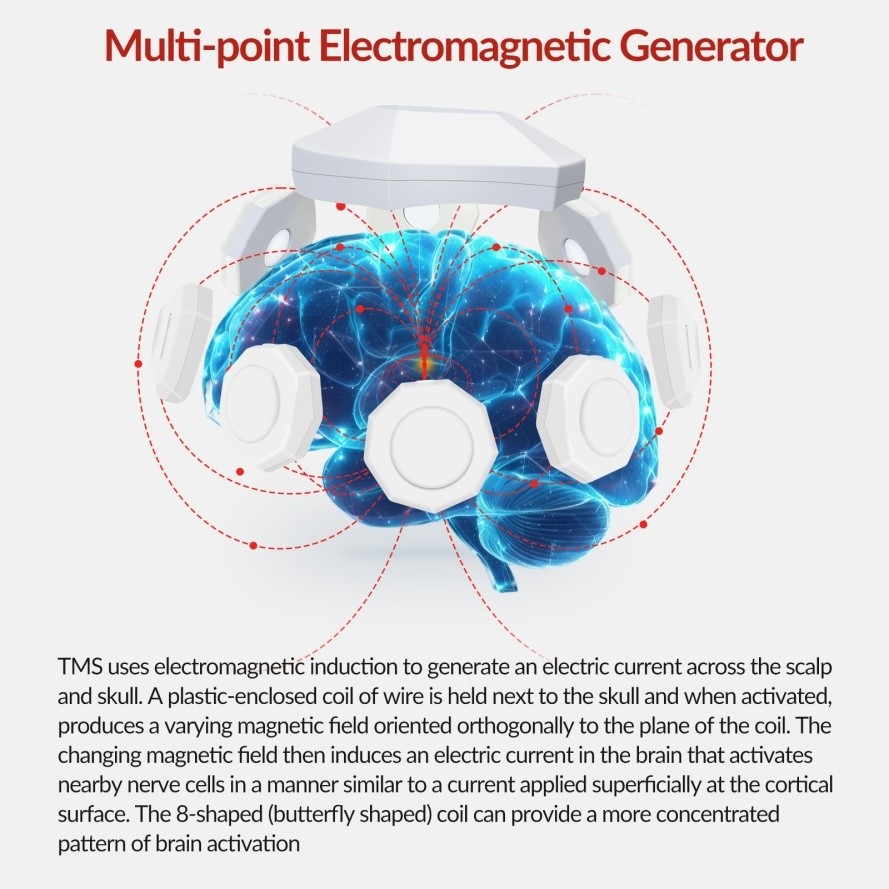 Transcranial Stimulation Therapy for Anxiety and Depression Brain rTMS Machine