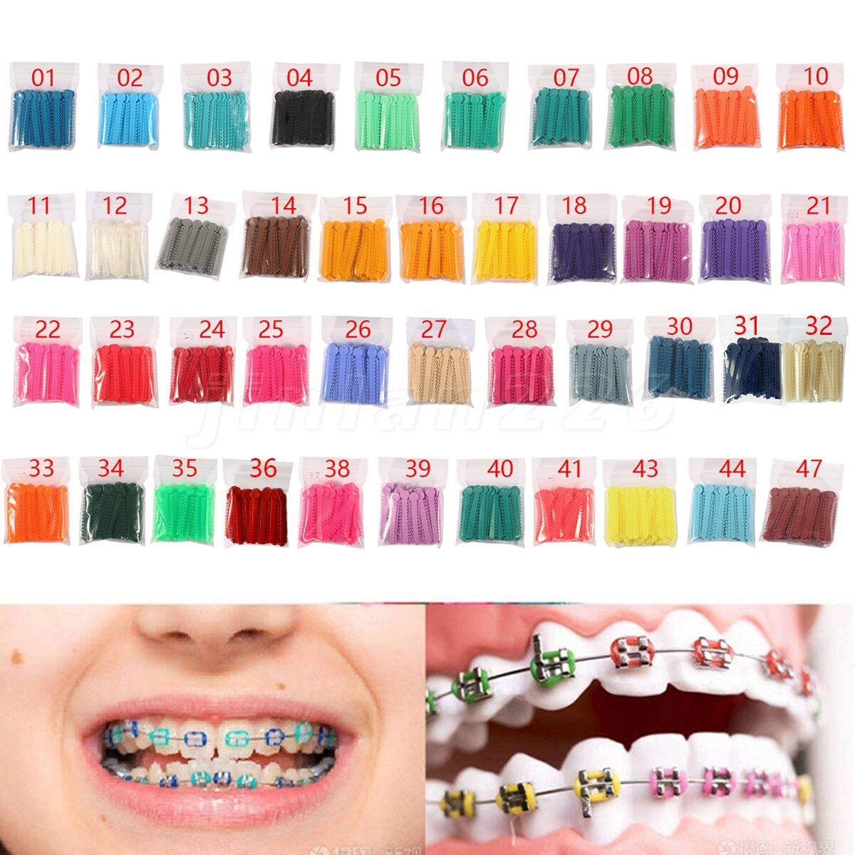 1040 Orthodontic Ligature Ties Elastic Rubber Band Ligadura Ortodoncia Bracket