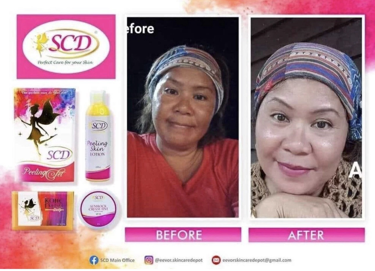 SCD Peeling Set