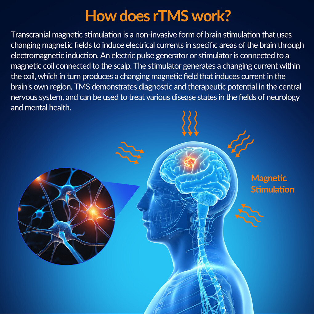 rTMS Therapy Transcranial Magnetic Stimulation Treatment Resistant Depression US