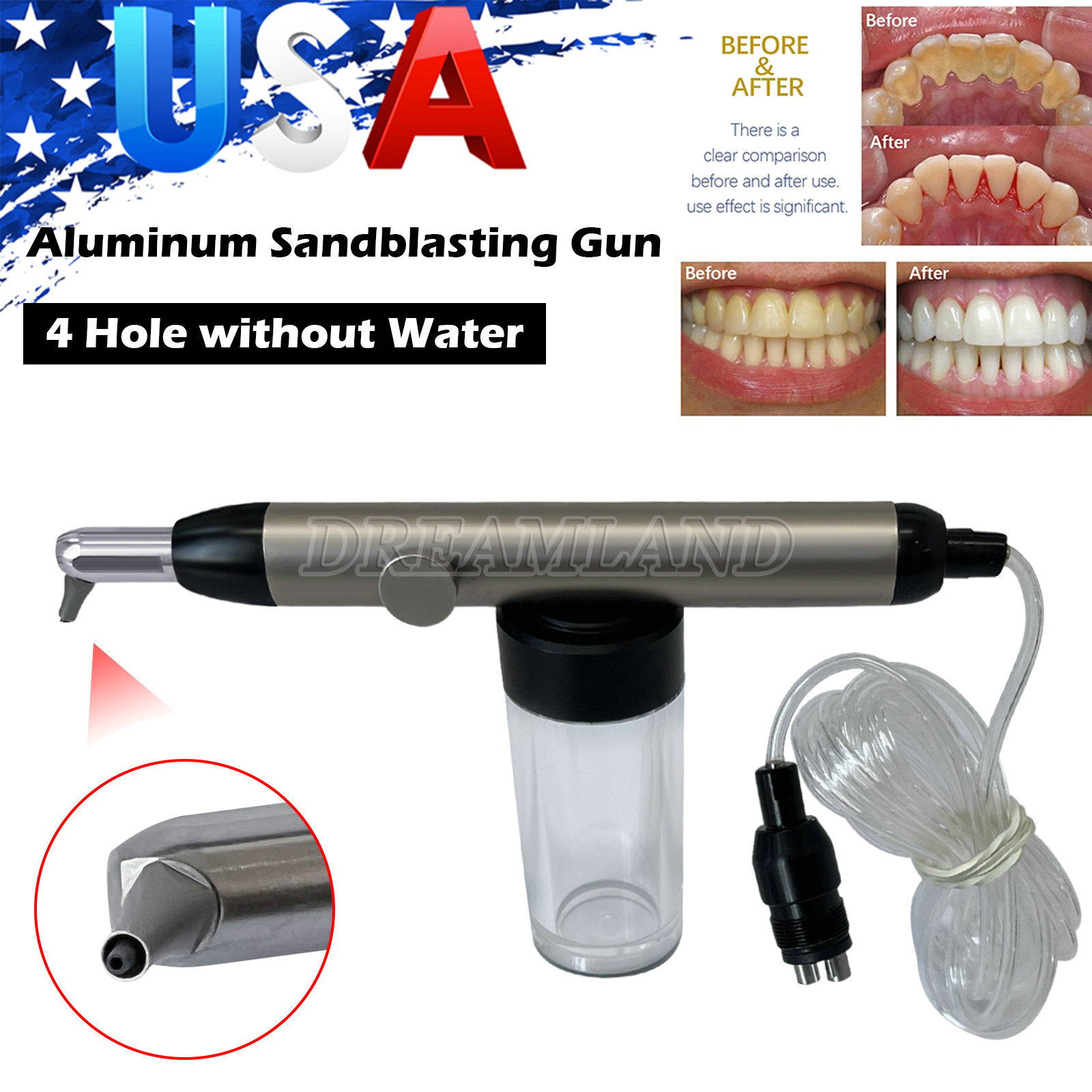 Dental Alumina Air Abrasion Polisher Sandblasting Sandblaster Prophy Gun 4 Holes