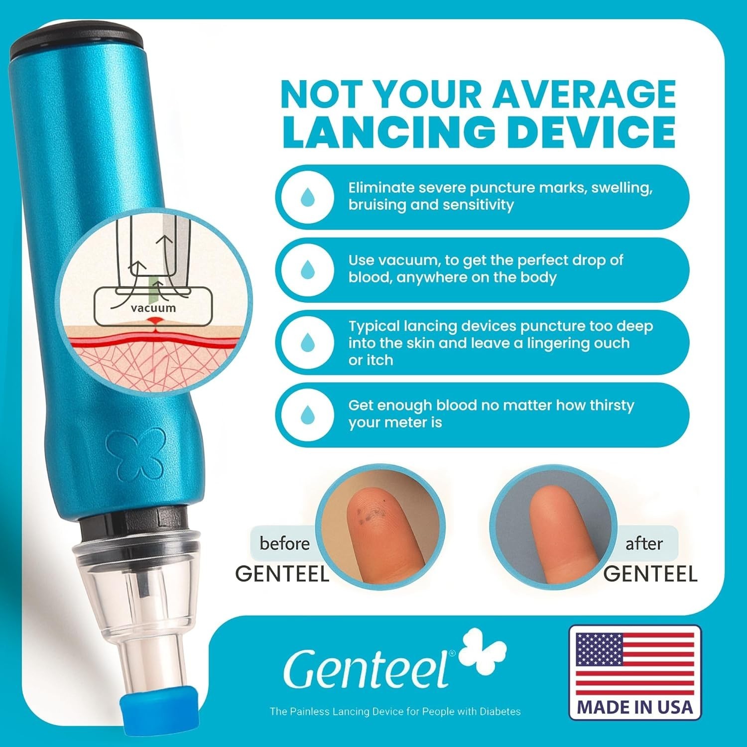 Comfortable Lancing Device: Vacuum Tech, No Squeezing, Near Painless