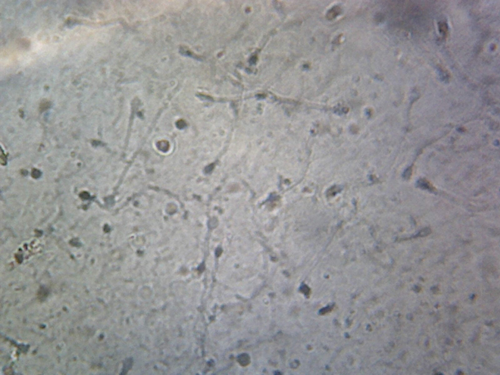 Sperm, Human; Smear
