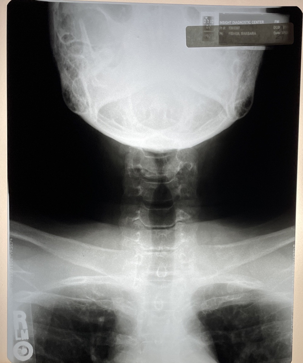 Xray Film Neck Spine X-ray Oddity Medical Teaching Halloween Decor Prop 9 x 11