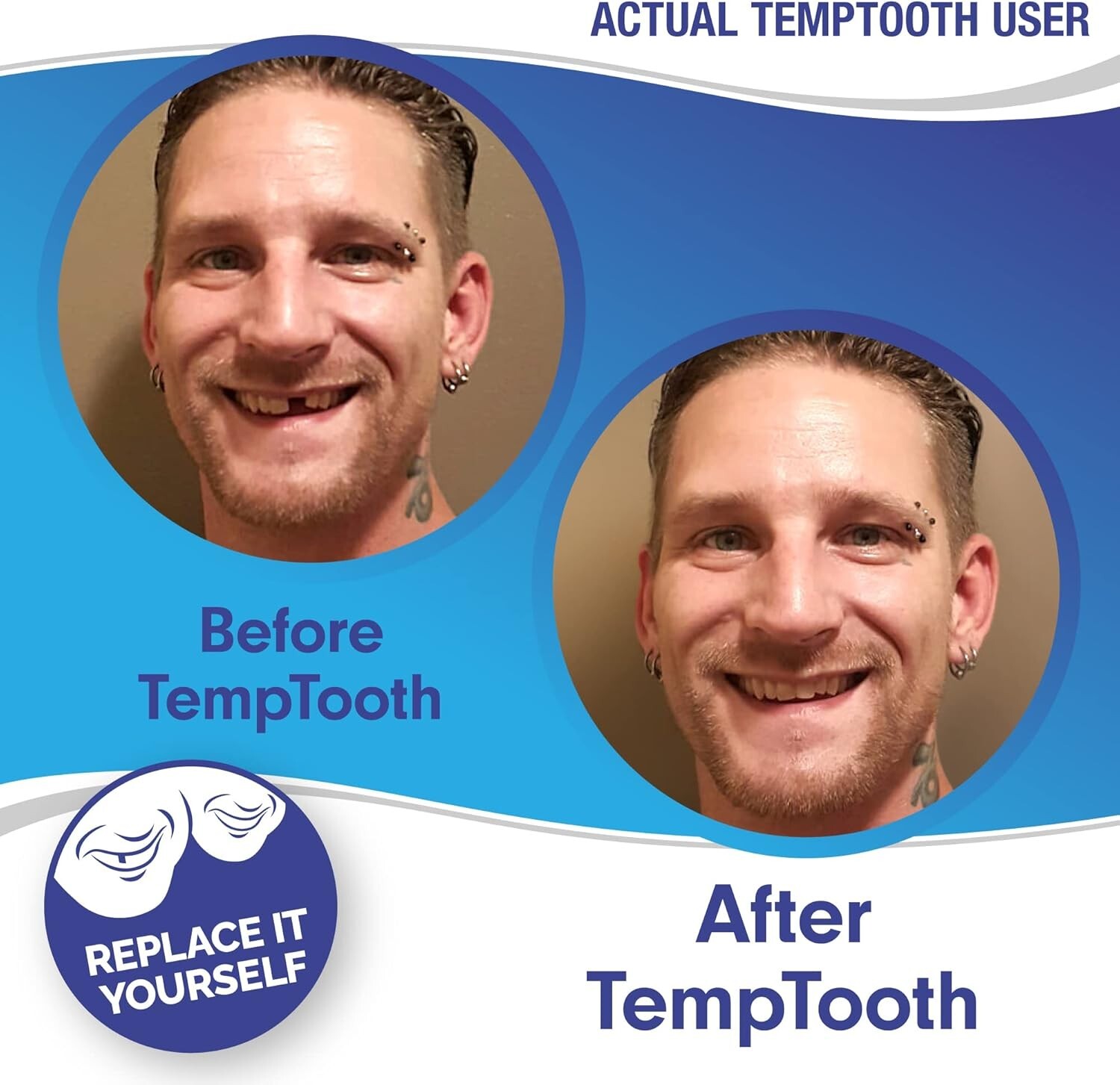 Temporary Tooth Replacement Kit Moldable Approved Easy Fix for Missing Teeth