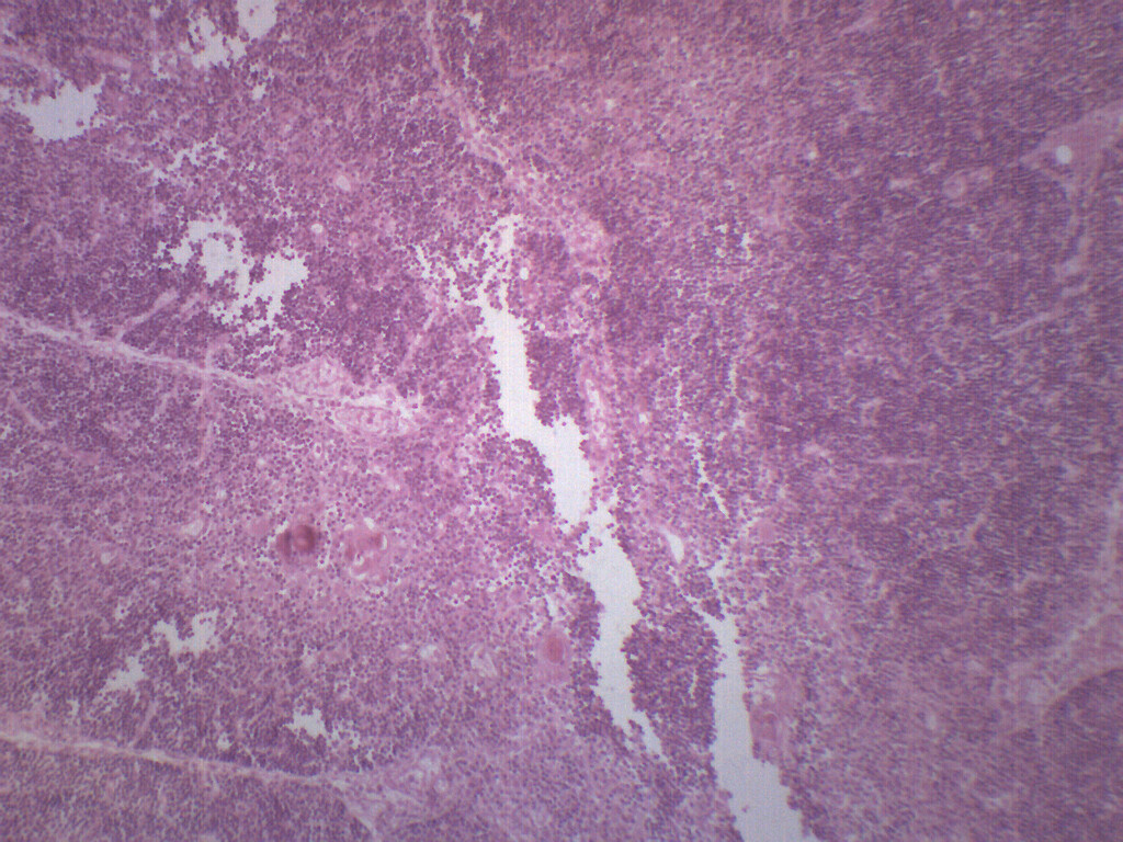Thymus - Prepared Microscope Slide - 75x25mm - Eisco Labs