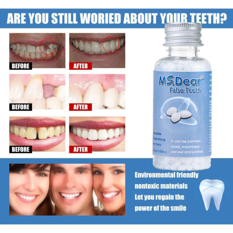Tooth Repair Kit - Temporary Teeth Replacement Kit for Missing & Broken Teeth