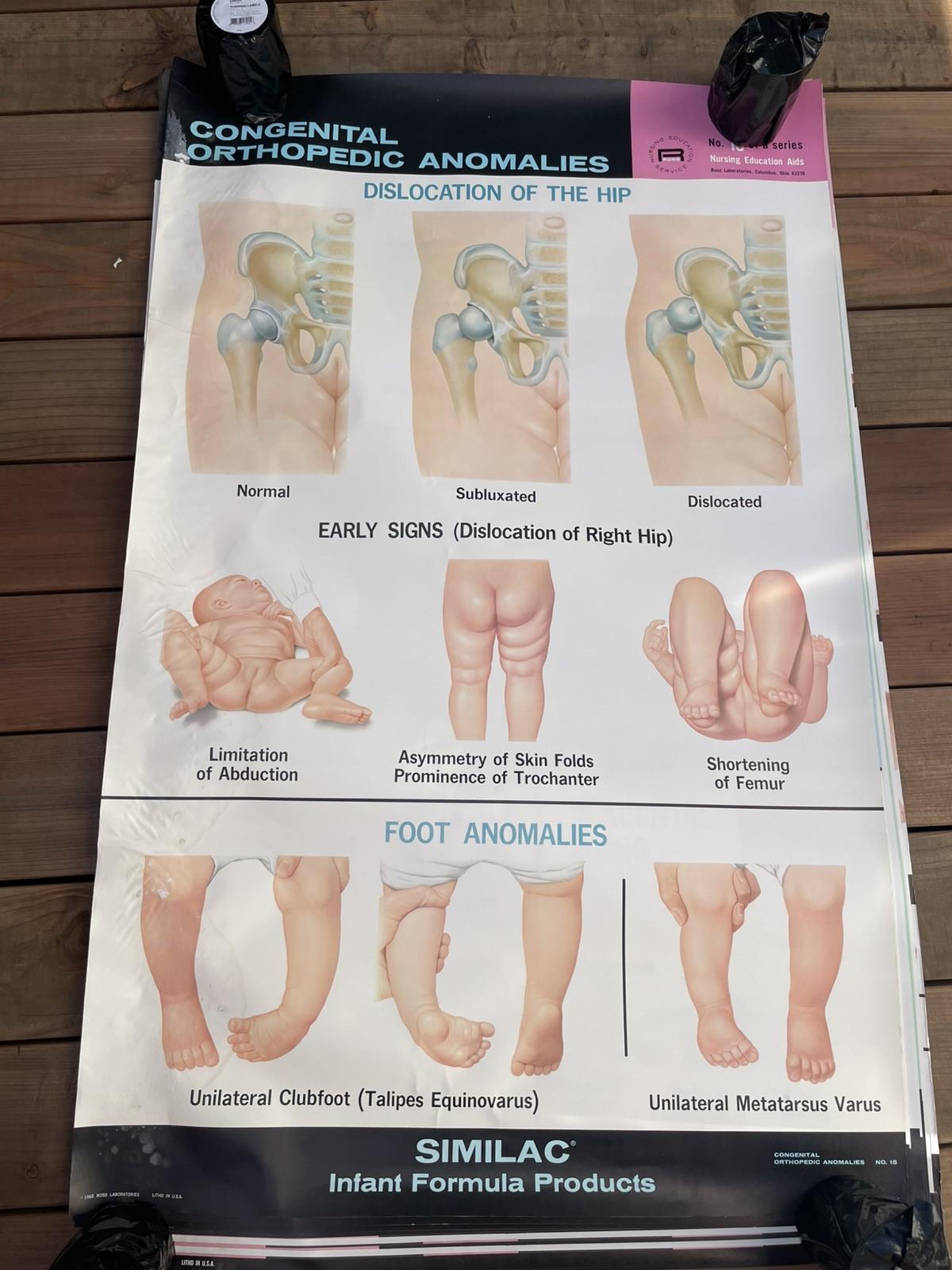 VINTAGE 1965 SIMILAC NURSING POSTER ORTHOPEDIC ANOMALIES ROSS LABORATORIES