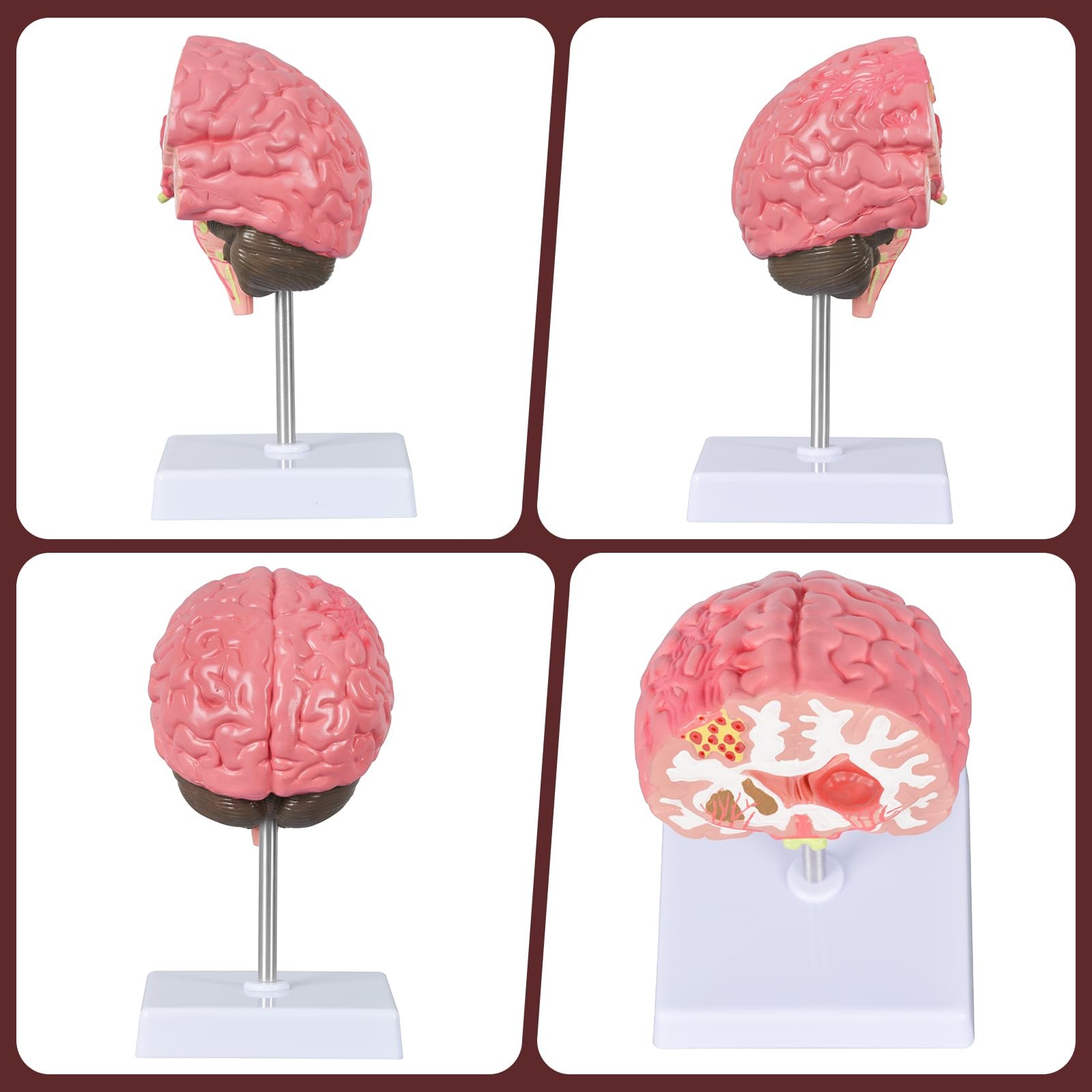 Brain Stroke Anatomy Model, Life-Size Human Brain Structure Anatomical Model,...