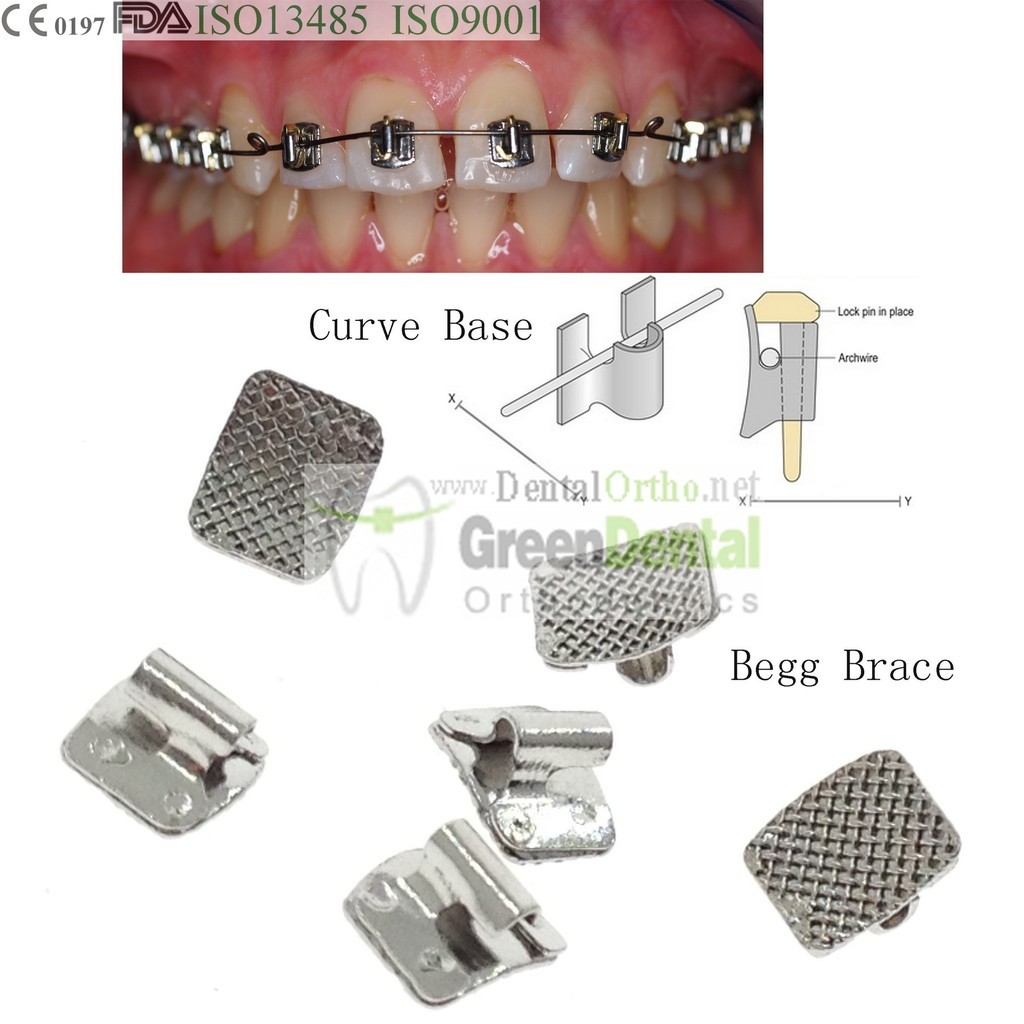 100/PK Begg Brace Curved Dental Orthodontics Archwires Buccal Tubes Molar Bands