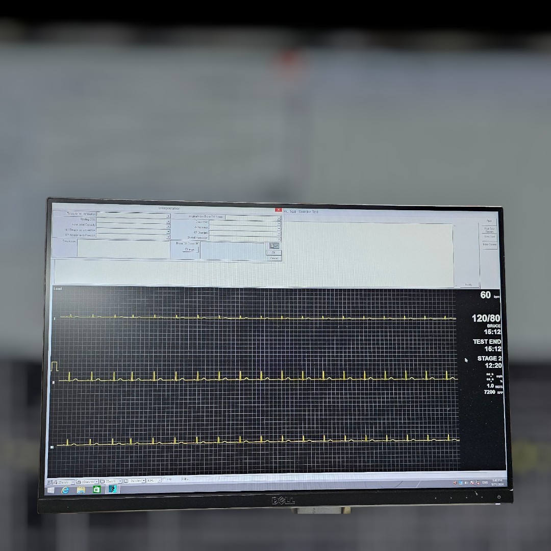GE Case Stress System Windows 10 Ver.6.73