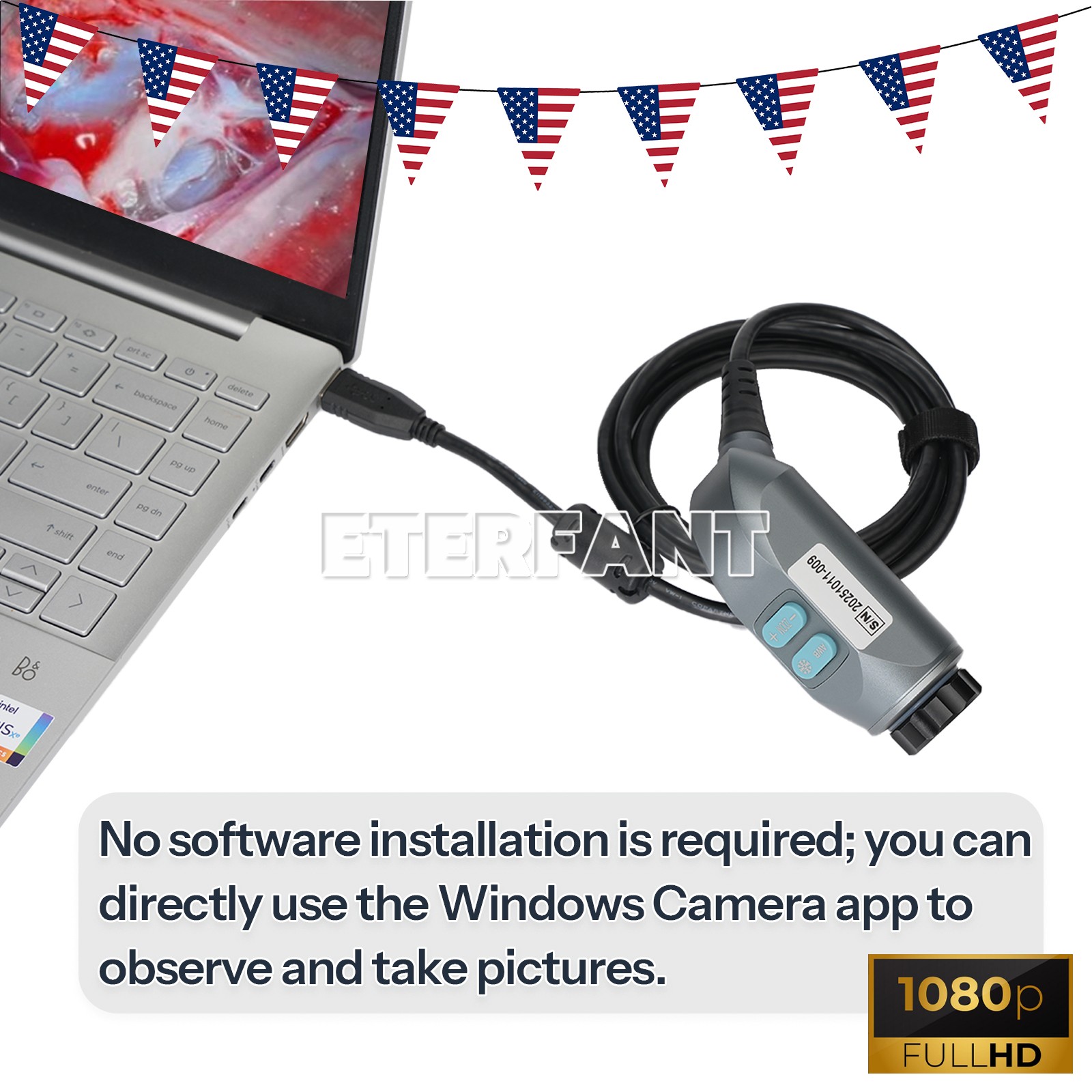ETERFANT 1080p Full HD Endoscopy Laparoscopic Camera/ 80W LED Cold Light Source