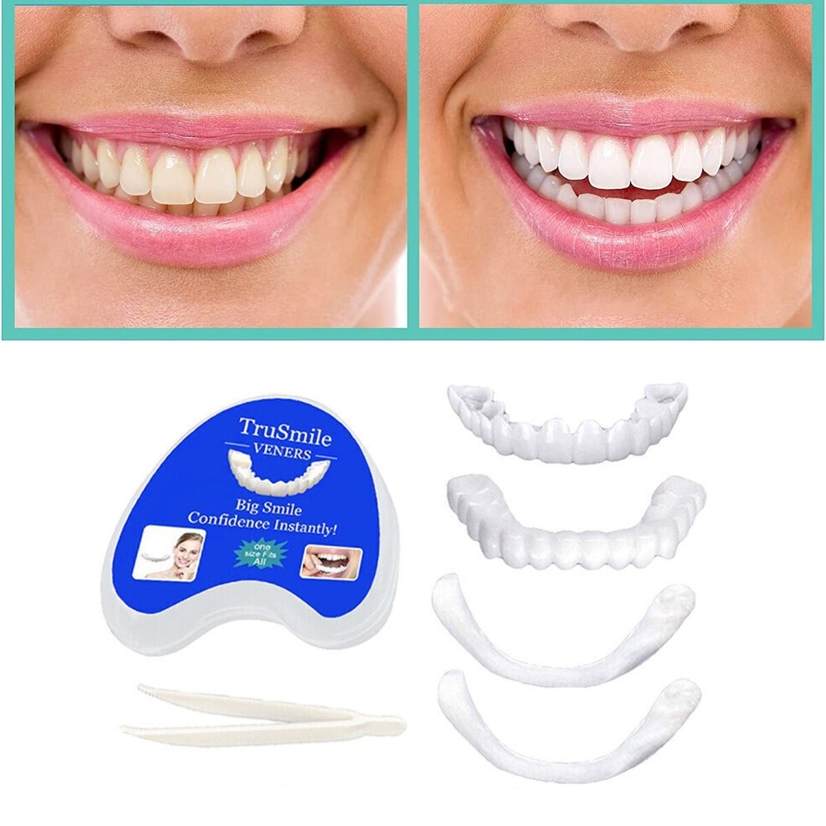 Snap On Veneers Upper & Lower Set - Instant False Teeth Covers No Adhesive bex