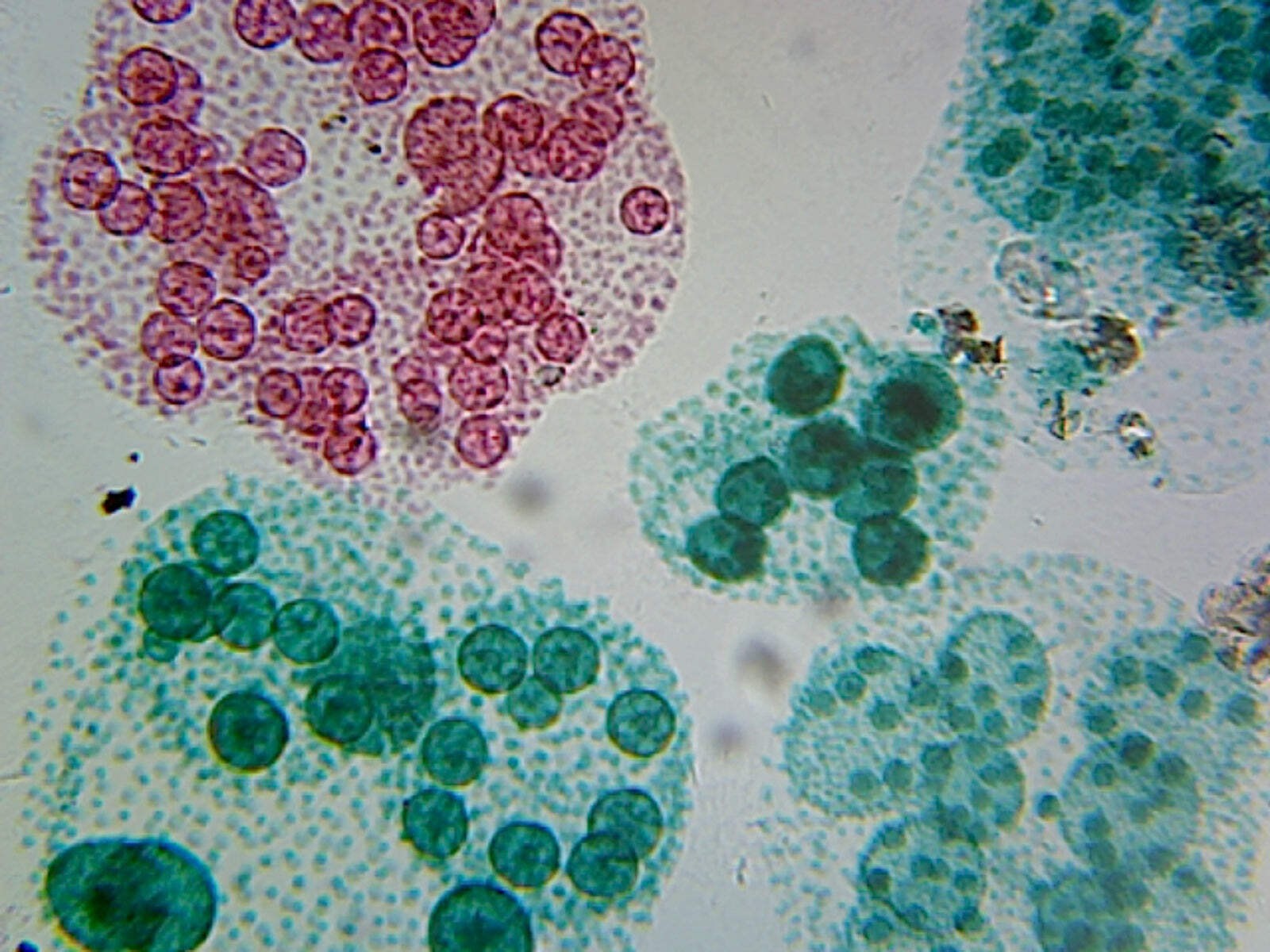 Microscope Slide, Volvox, Asexual, Reproduction W.M. Colonial Algae showing