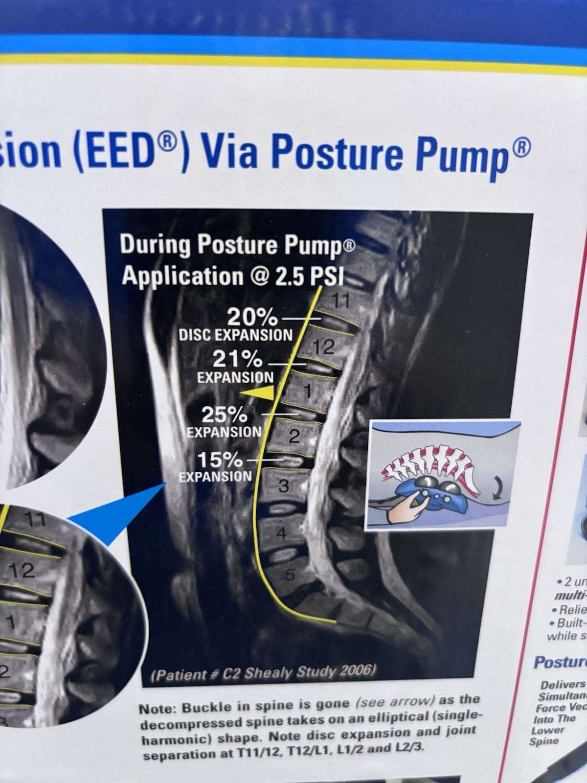New Posture Pump Disc Hydrator Elliptical Back Rocker Back Model 2000