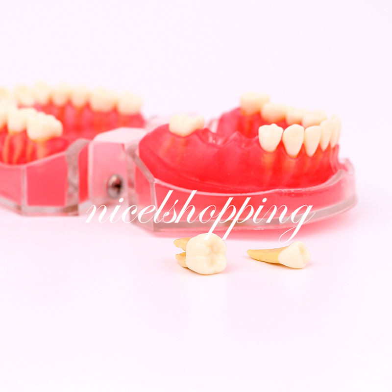 Dental Orthodontic Teeth Model 4004# with 28 Removeable Teeth Standard Plastic
