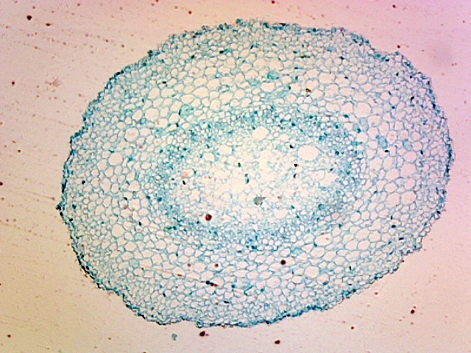 Lilium Root Tip; Typical Monocot Root; Cross Section