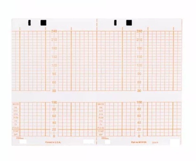 Cardio Graphics Philips Fetal ECG/EKG Monitoring Recording Paper M1910A 150mmx49