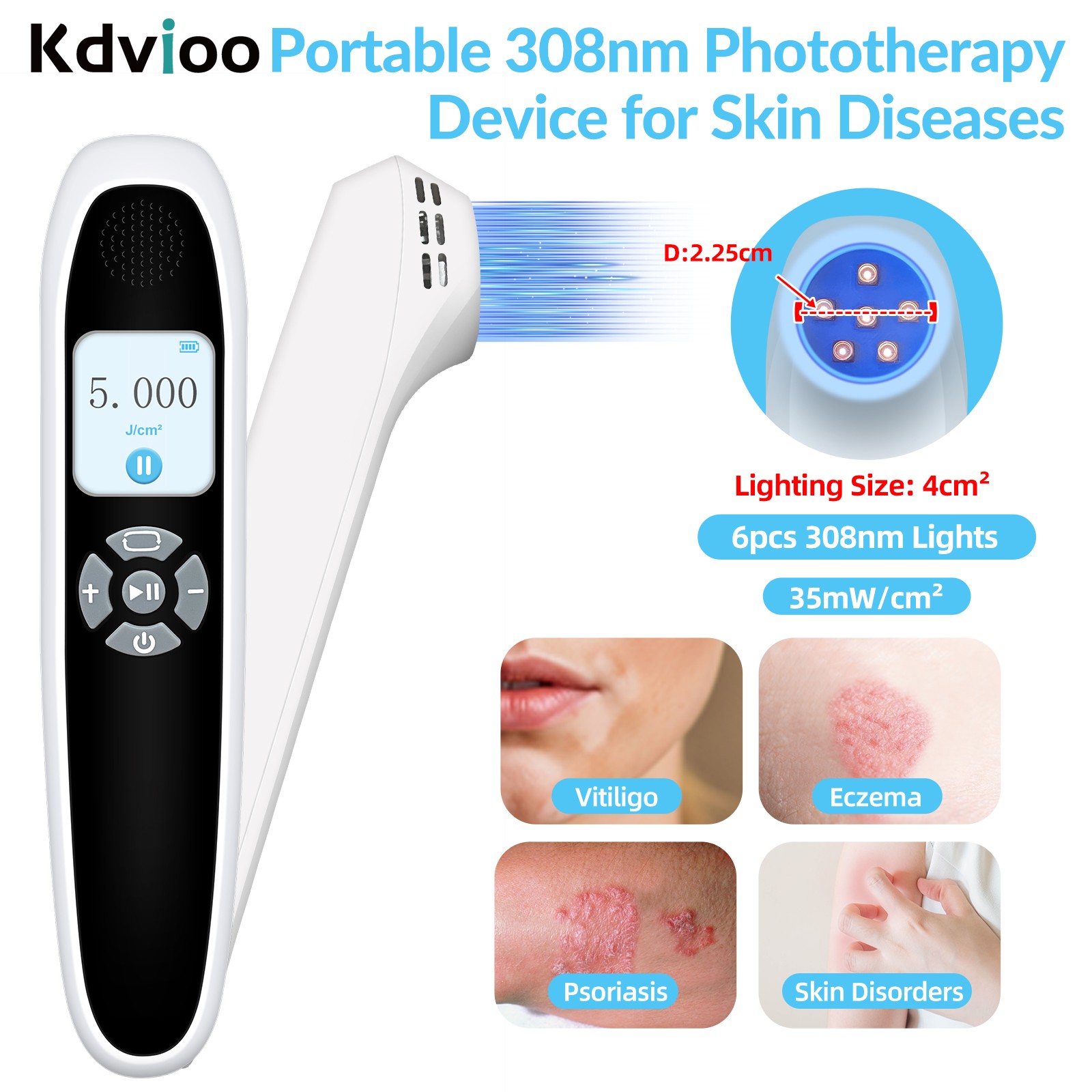 Home Phototherapy Device 308nm UVB Light For Treatment Of Stubborn Skin Diseases