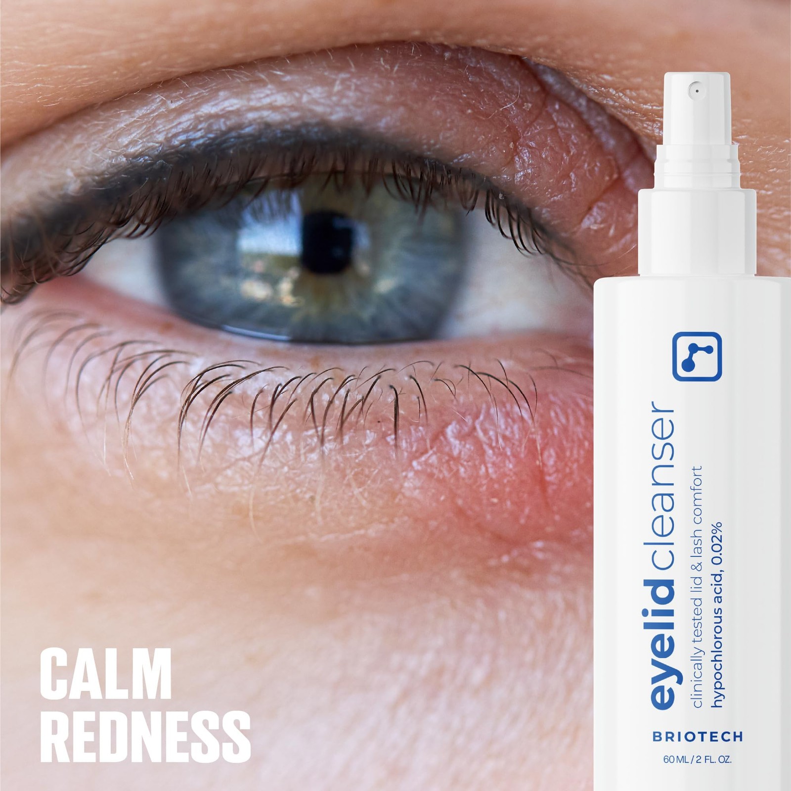 BRIOTECH Eyelid Cleanser, Hypochlorous Acid Spray, Lid & Eyelash Cleanser, Sooth