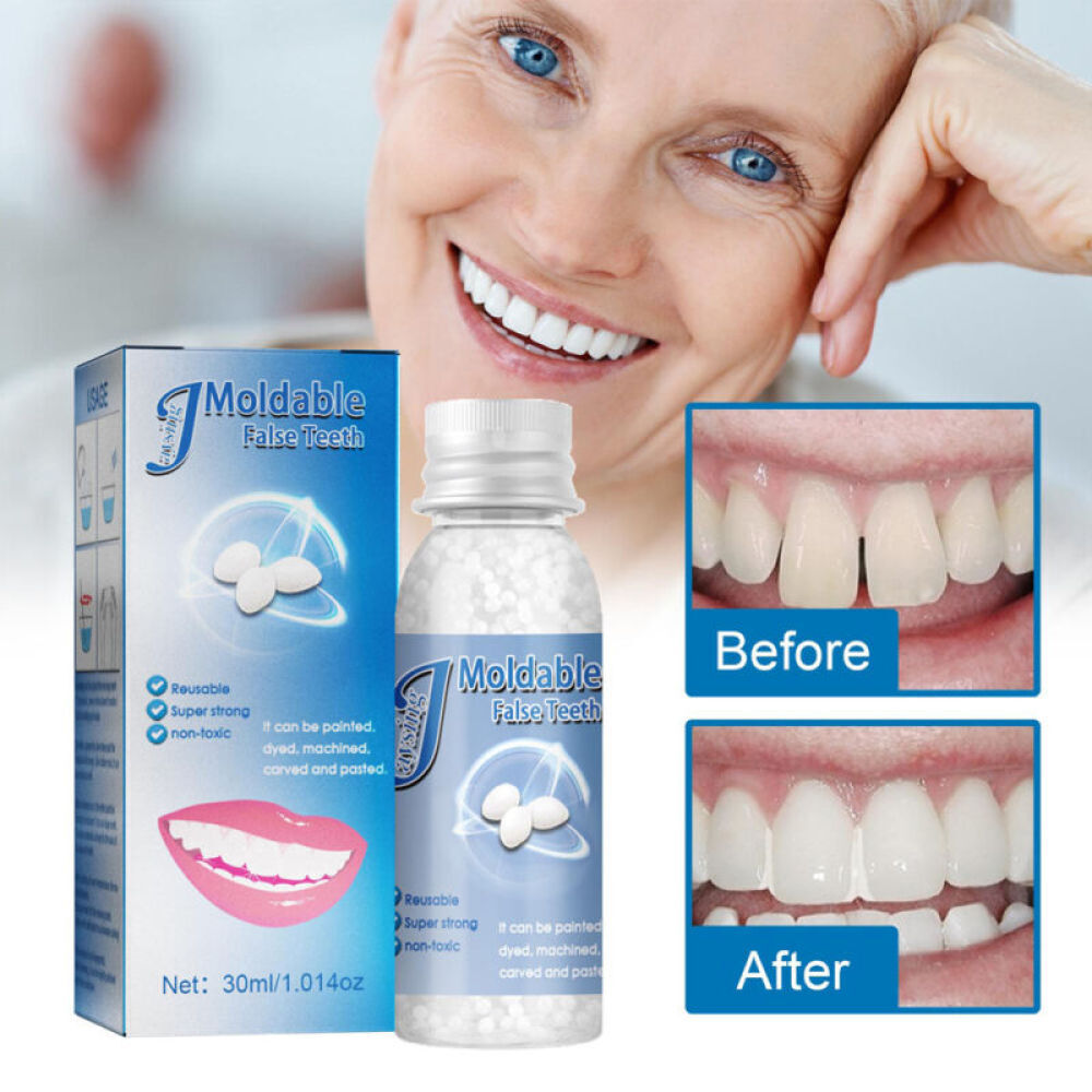 Tooth Repair Kit Temporary Teeth Replacement Beads for Missing & Broken Teeth