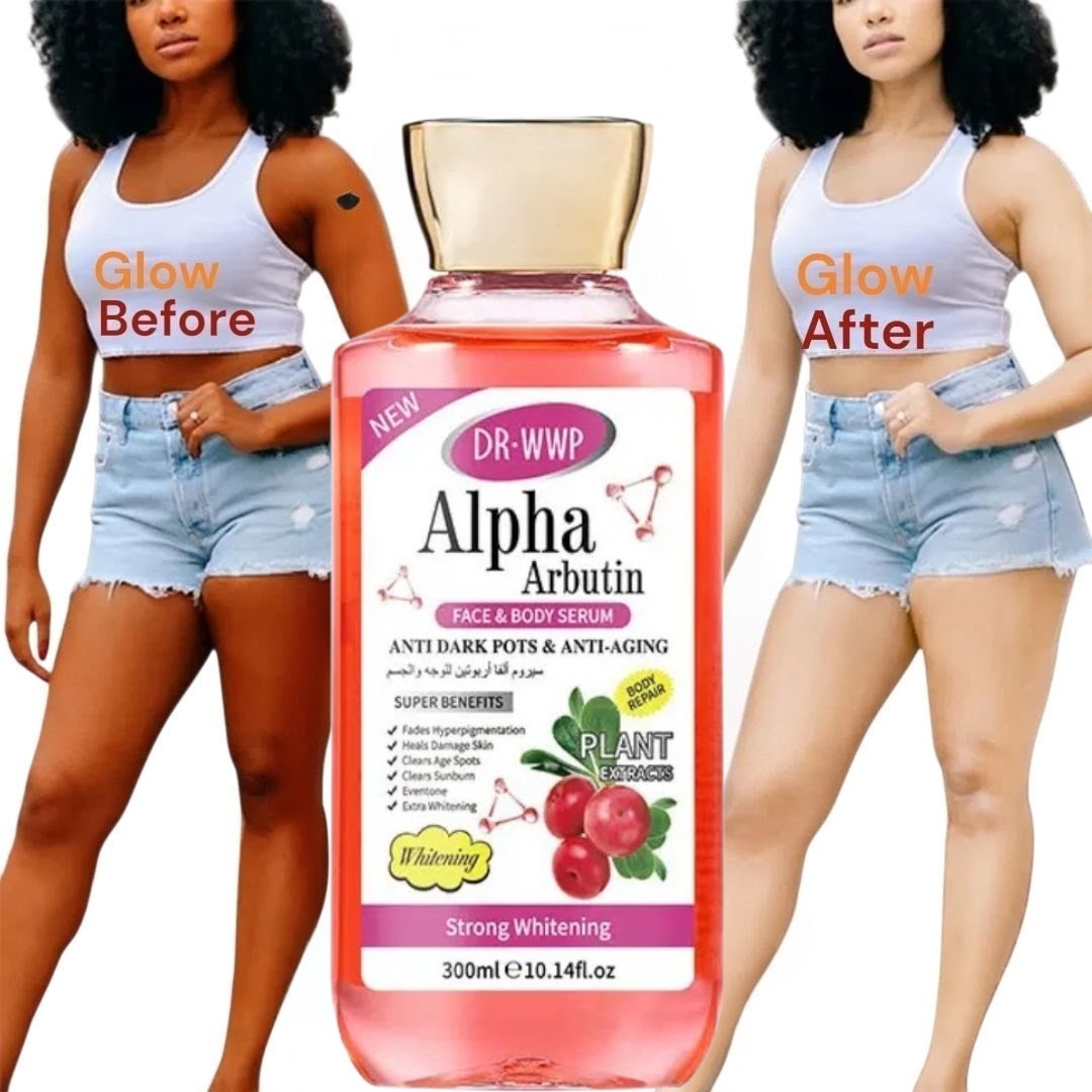 Alpha Arbutin Face Body Serum Skin Brightening Anti-Darkspots, 300ml [USA Stock]
