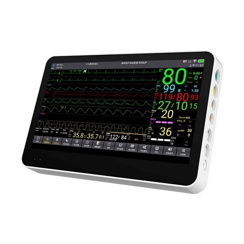 14" Touch Screen ICU/CCU Patient Monitor with ETCO2, Multiparameter Vital Signs