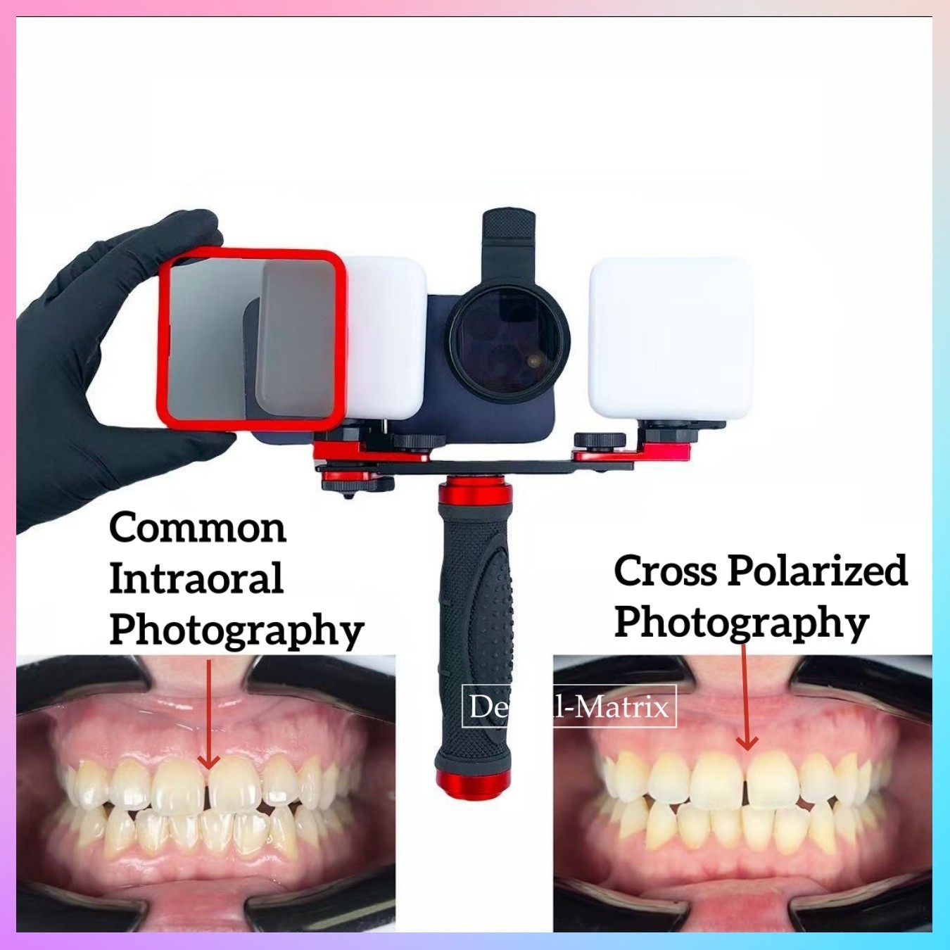 Oral Dental LED Filling Light Lamp Mobile Phones Cross-polarization Photography