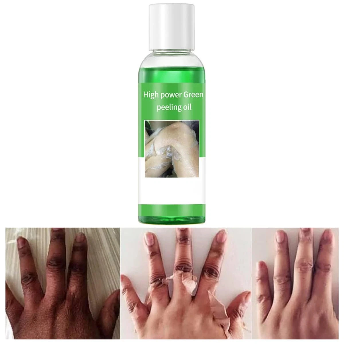 Peeling Oil for Dark Skin, Green Peeling Oil, Facial Peels with Hyaluronate,E...