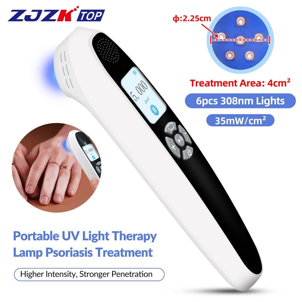308nm UVB Lamp Localized Phototherapy for Face Hand Foot Skin Disorders 35mW/cm²