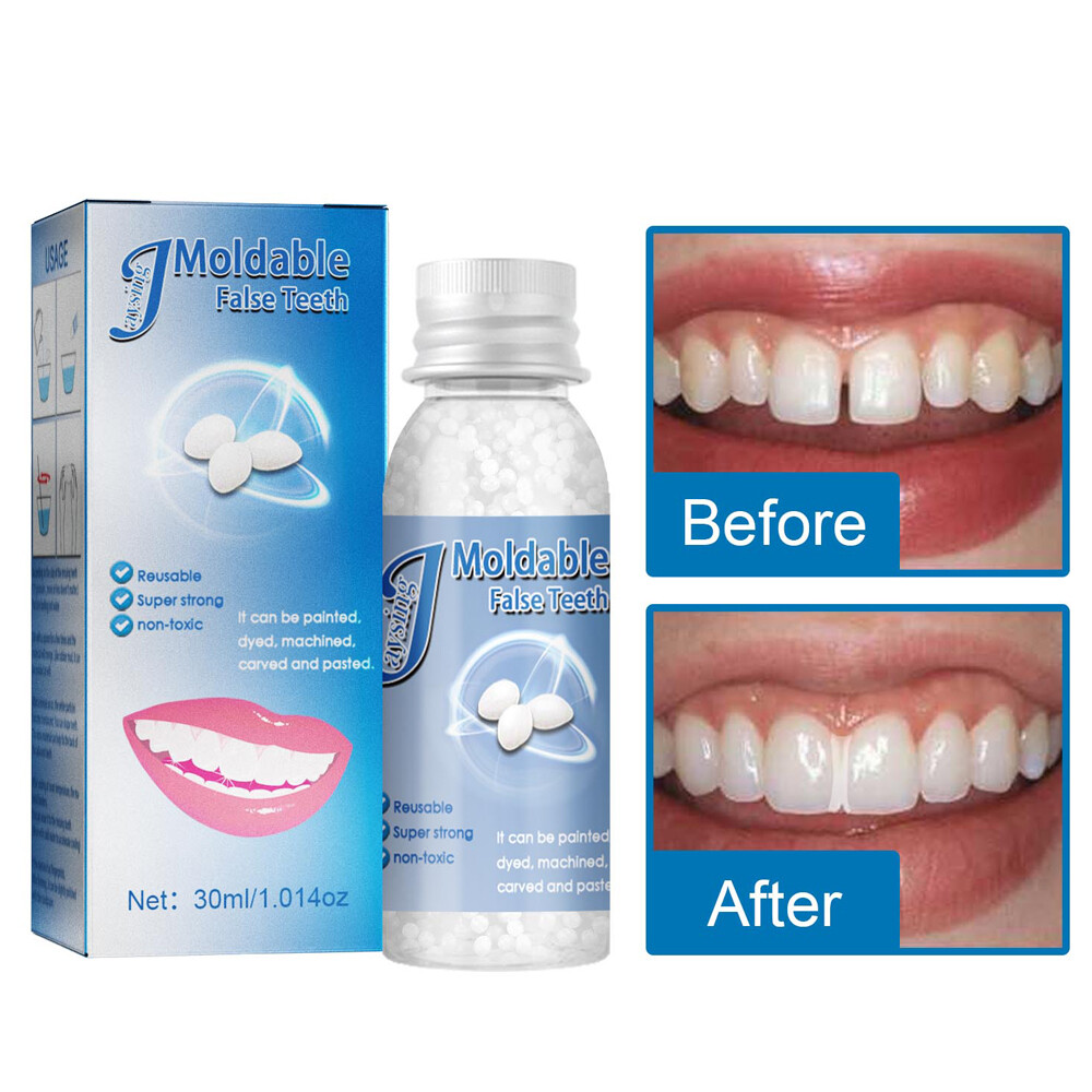 Temporary Tooth Repair Kit Temp Dental Repair Granules Replace Missing DIY Make