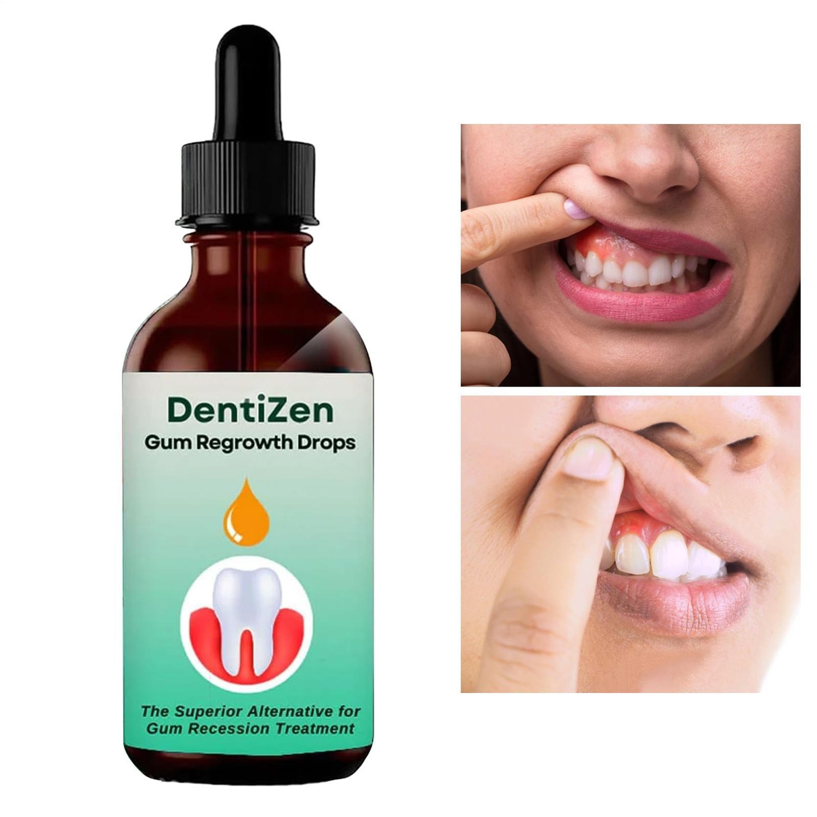 Dentizen Gum Therapy Gel, Gum Regrowth for Receding Gums, Gum Repair Regrowth