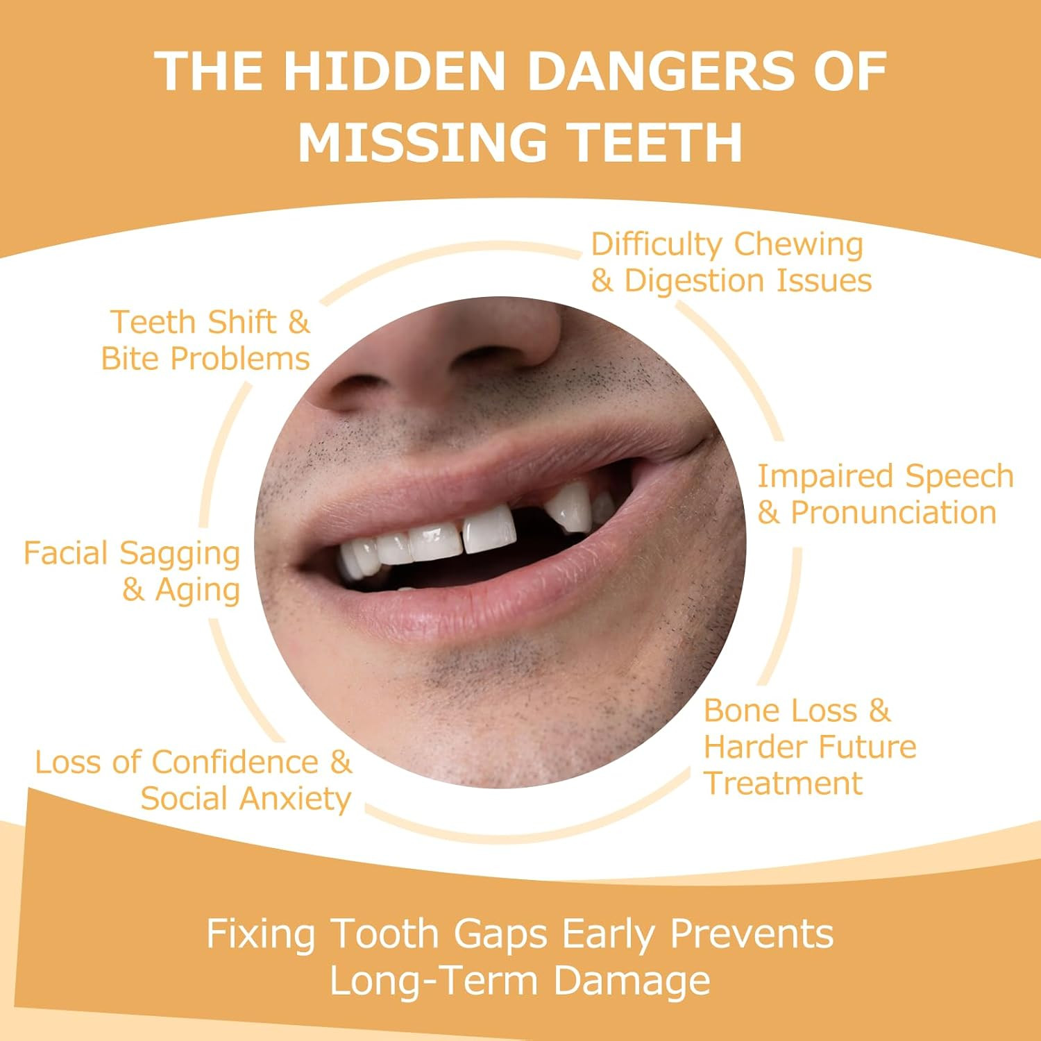 Partial Dentures - Dentures for Missing Teeth & Gaps - Lightweight & Unbreakable
