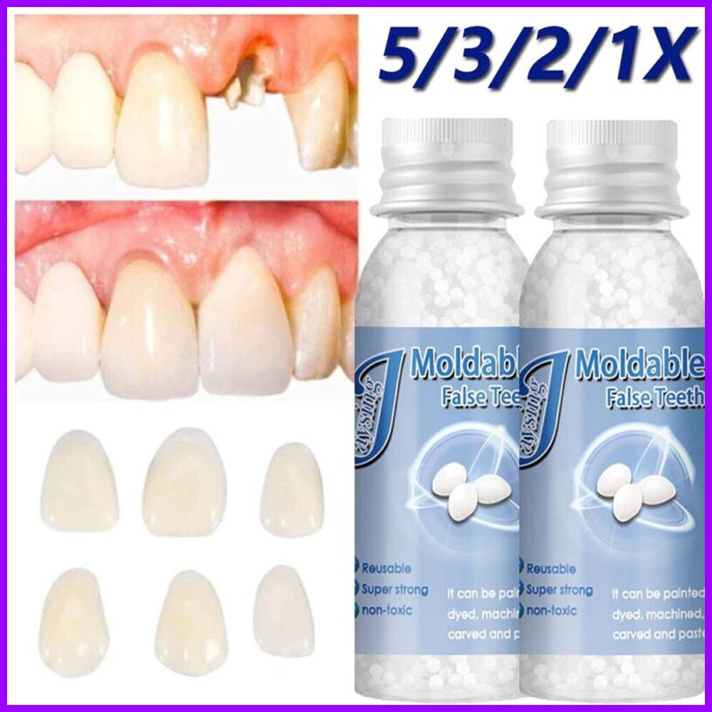 False Teeth Solid Glue Temporary Tooth Repair Resin Moldable Teeth Gap Denture