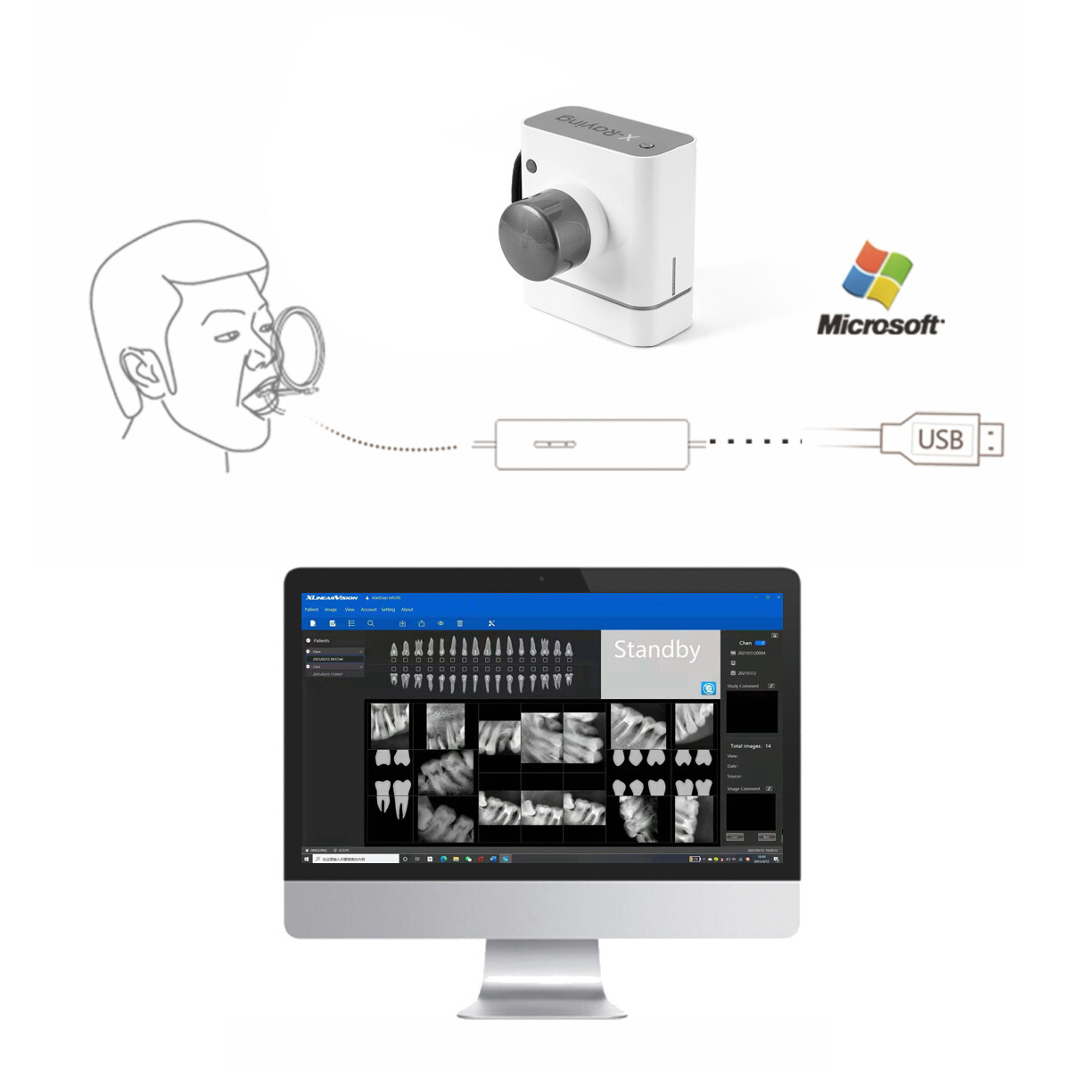 Dental X-Ray Sensor Digital RVG Imaging Senser System Fit for All Xray Machine